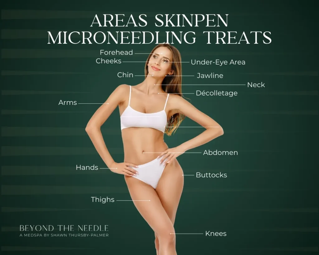 List of areas SkinPen Microneedling treats