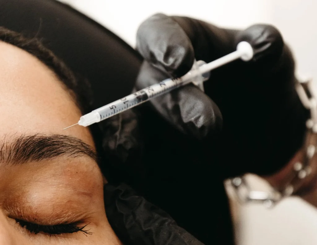 what to expect Xeomin